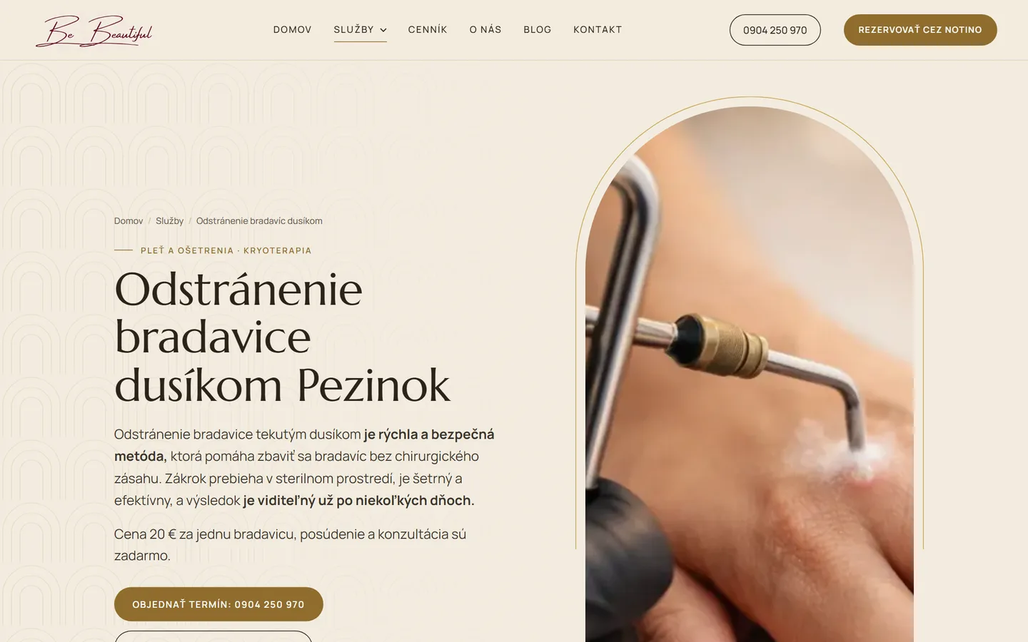 Nový web Be Beautiful: stránka služby odstraňovania bradavíc tekutým dusíkom